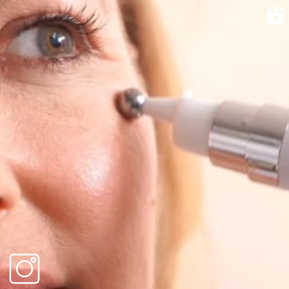 model using eye cream