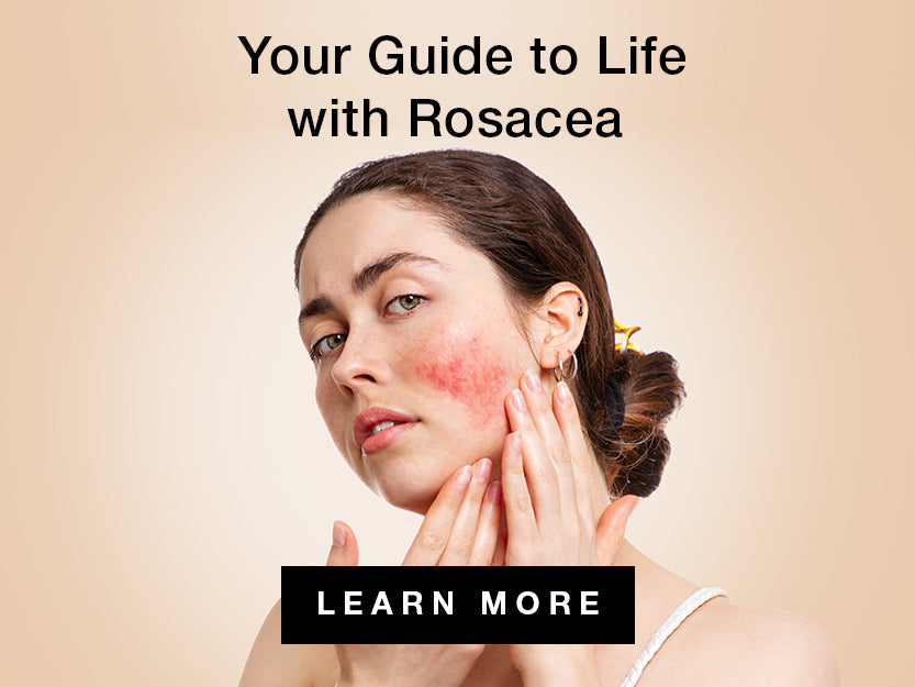 expert guide on Roseacea